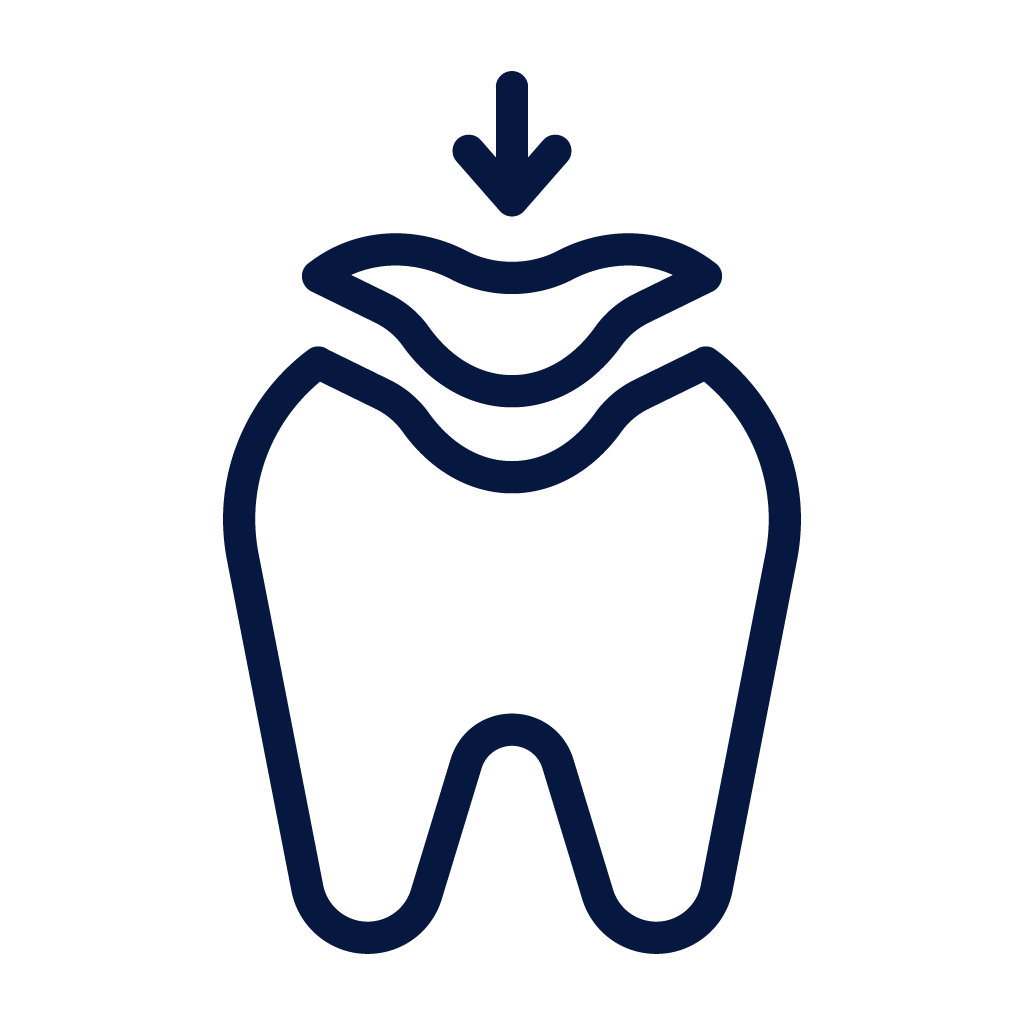 Teeth Whitening